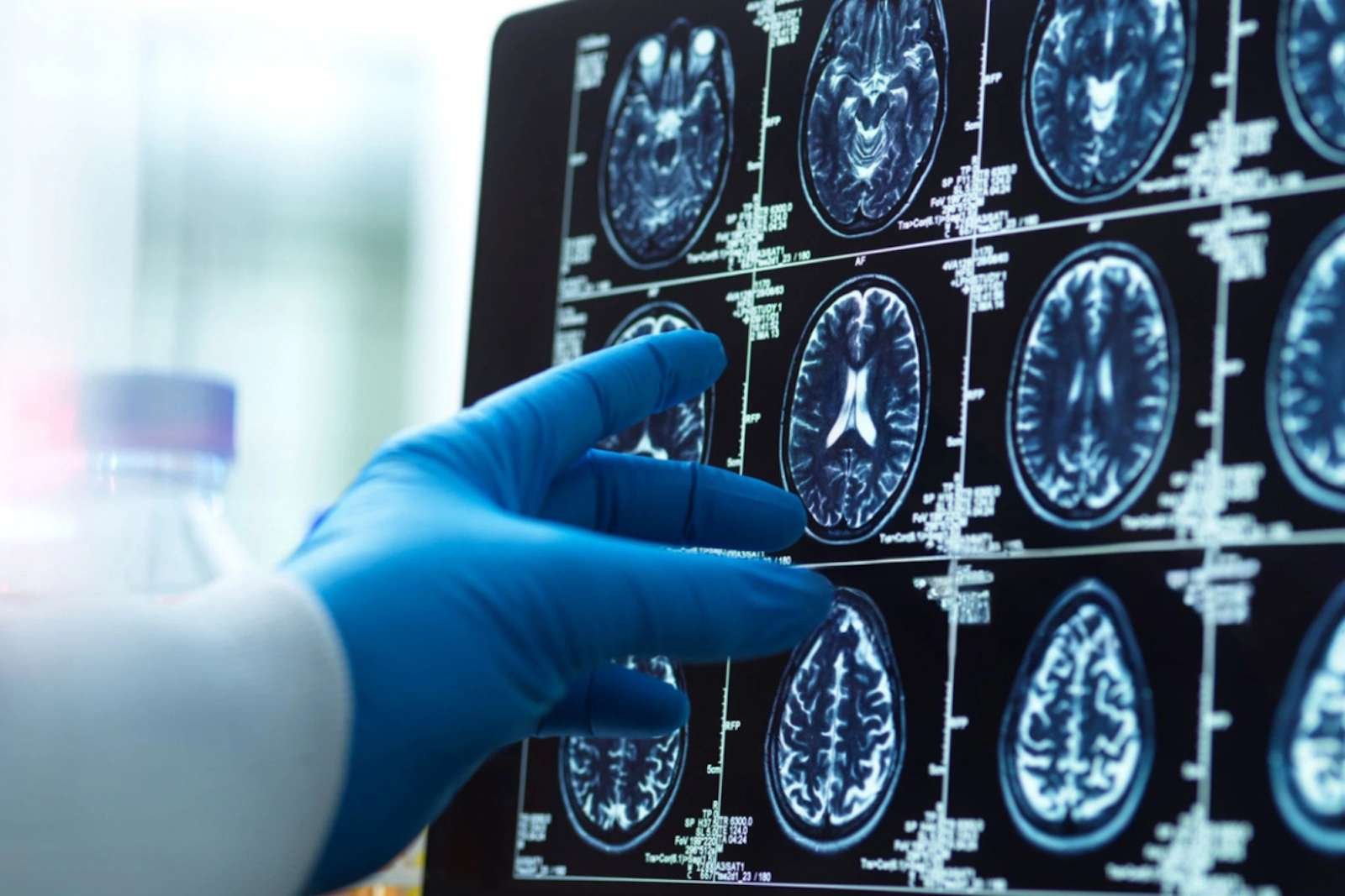 Lien entre cerveau et alimentation