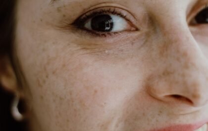 Resserrer les pores dilatés naturellement : les solutions