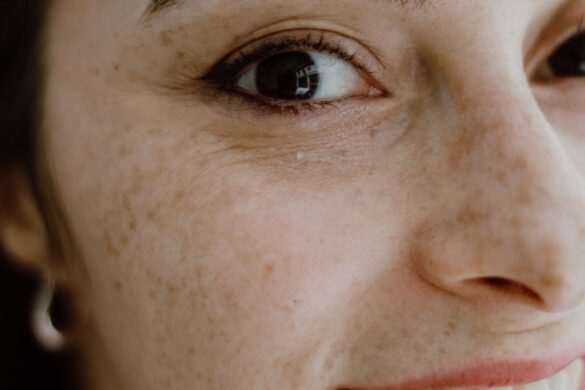 Resserrer les pores dilatés naturellement : les solutions